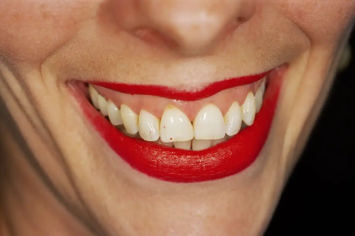 Martin Parr, Chroniqueur désabusé de l'emprise des signes